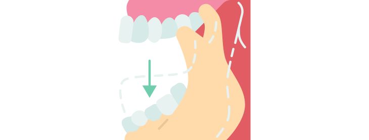 Clicking or painful jaws when you chew